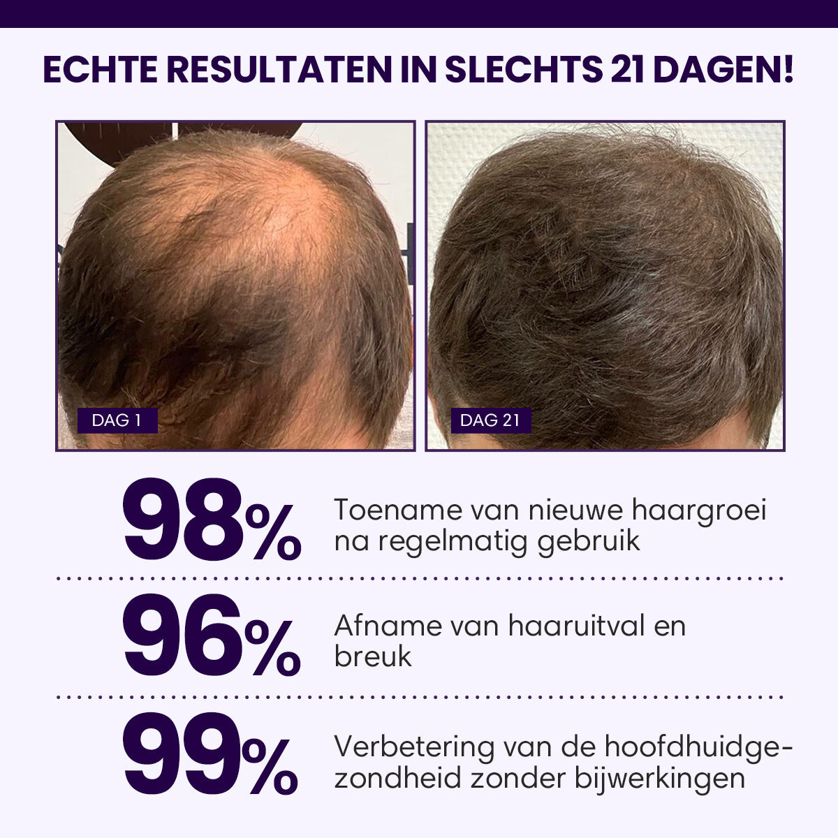 Luhaka™ FollicaMax 25,000 MCG Haargroei Ondersteuning ⚙️4